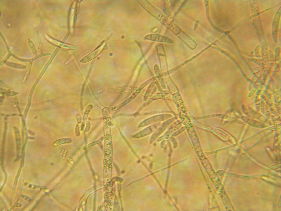 Lichtmikroskopie: Fusarium-Konidienträger mit sichelförmigen Makrokonidien bei 160-facher Vergrösserung